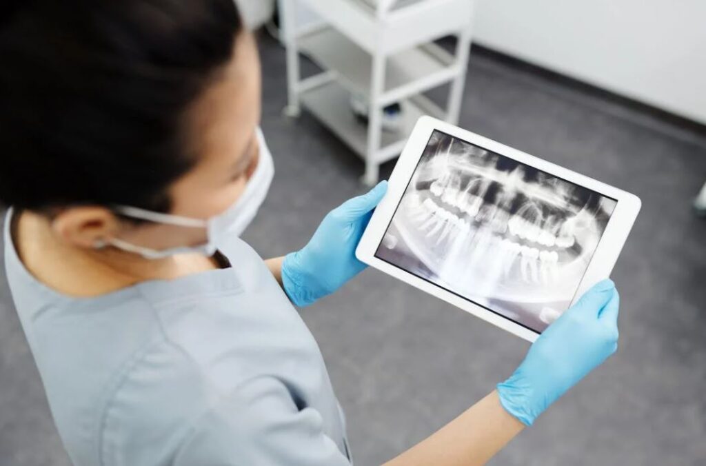 implantes dentales en iquitos